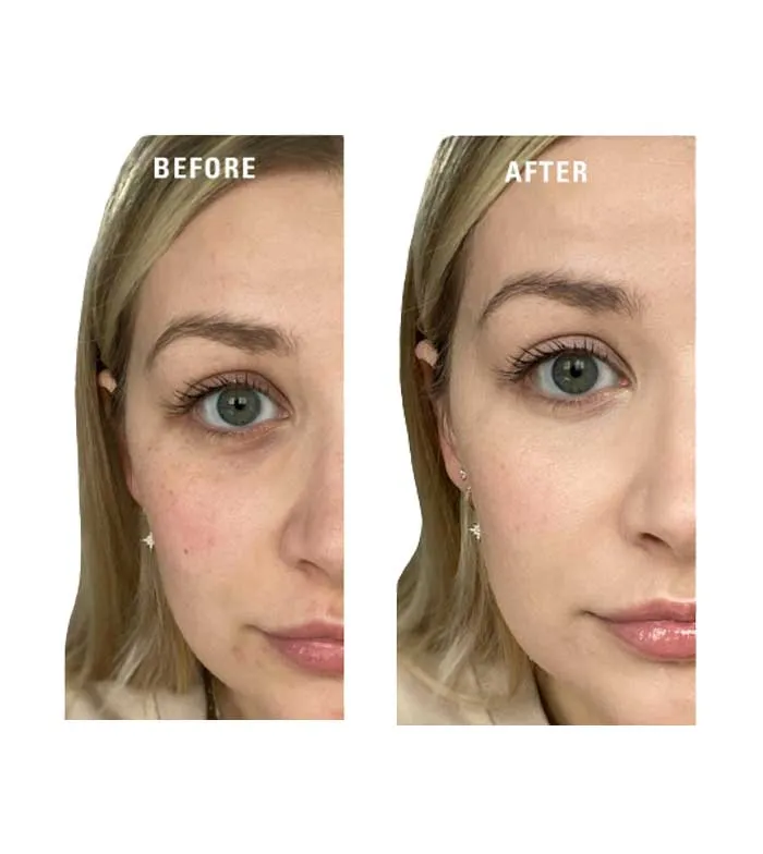 REVOLUTION  PREBASE DE COLOR EN CREMA SUPERBASE COLOUR CORRECTING  YELLOW